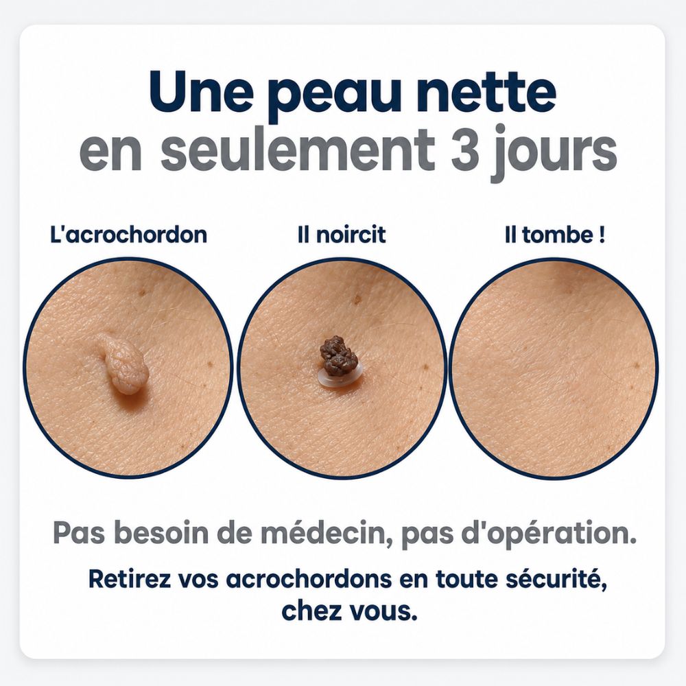 Proderma